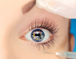 Everything you need to know about intravitreal injections
